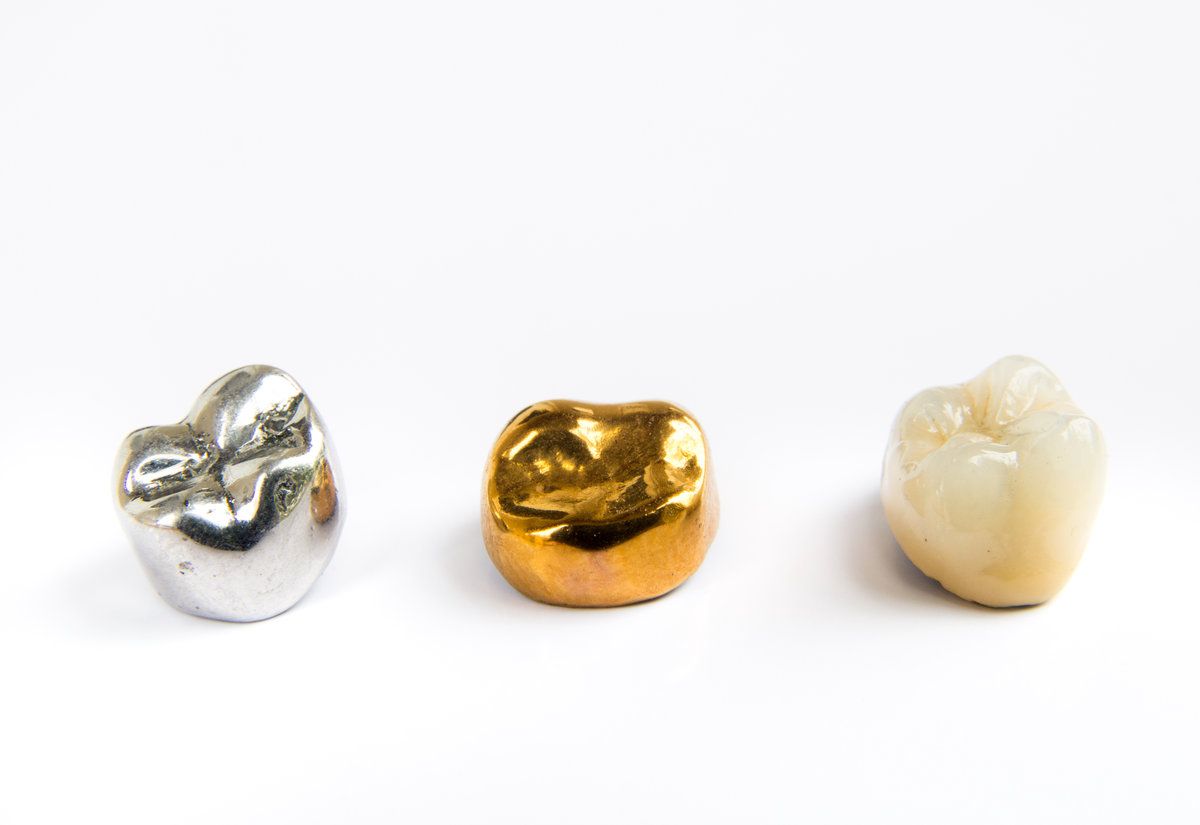 Three dental fillings in different materials