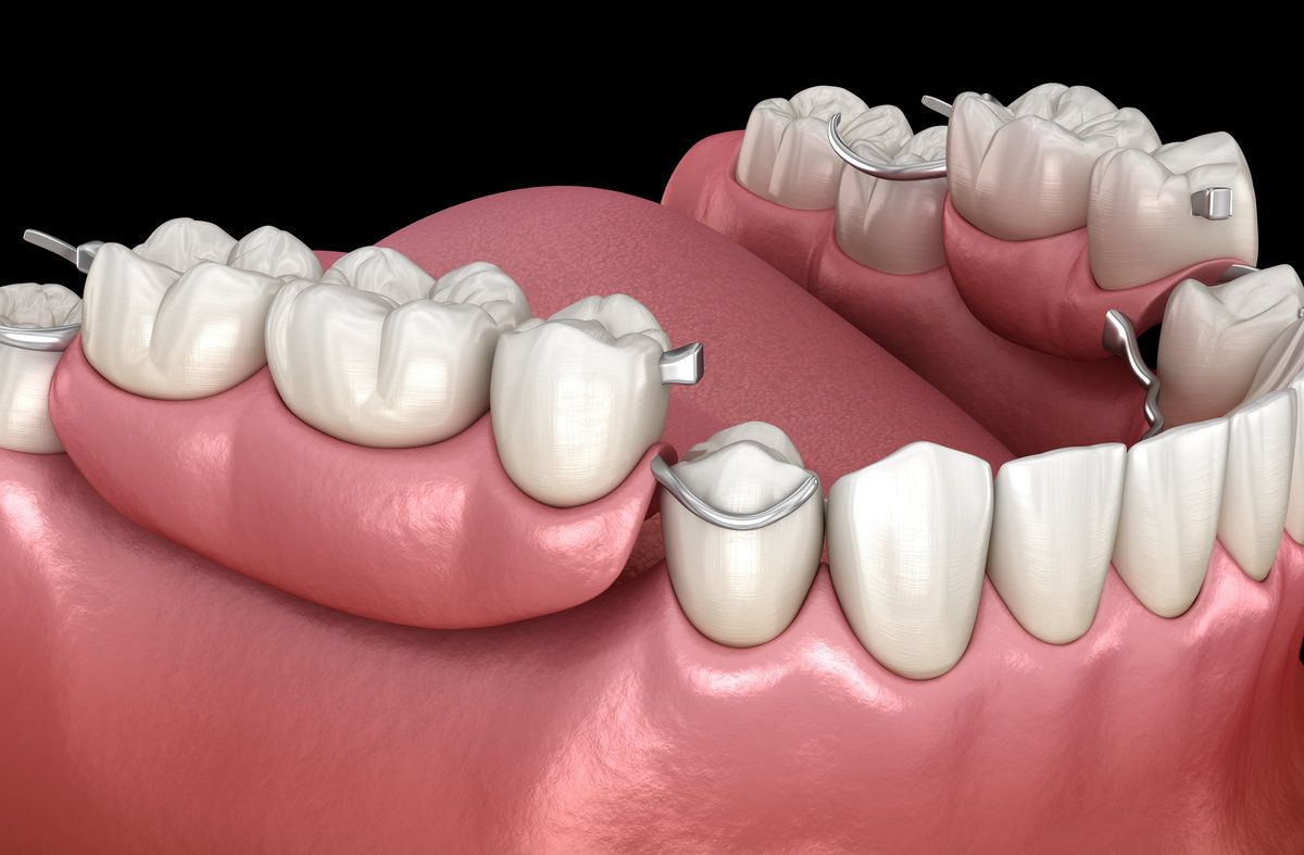 3D model of human teeth and gums