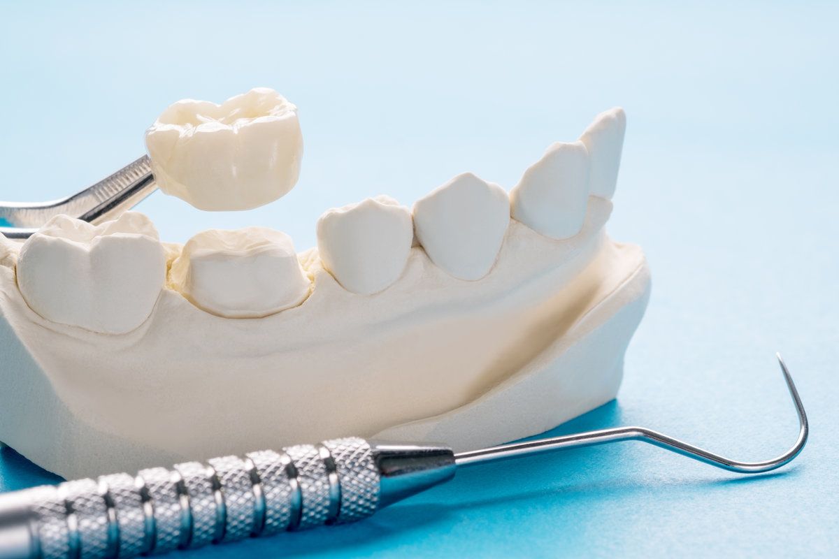 Closeup Prosthodontics or Prosthetic Single teeth crown and bridge equipment model express fix restoration
