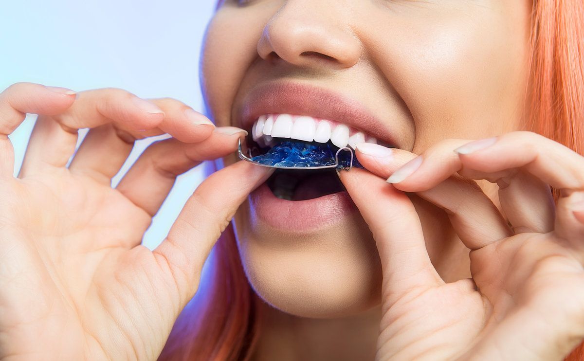 Smiling Girl with Retainer for Teeth, Close-up